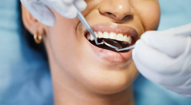 Best Emergency Dental Services for Seniors in Valley City, ND